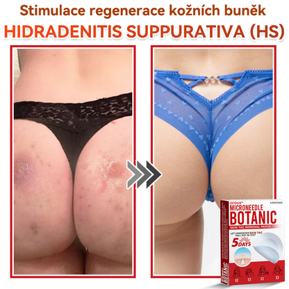 🎁 Zbývá už jen 5 balení! Nabízíme další slevu 50 %! Buďte fit a zdraví! Využijte této příležitosti právě teď, protože další už nebude až do příštího roku.
