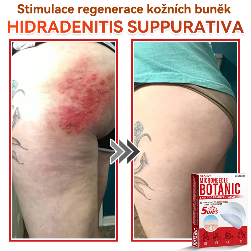 🎁 Zbývá už jen 5 balení! Nabízíme další slevu 50 %! Buďte fit a zdraví! Využijte této příležitosti právě teď, protože další už nebude až do příštího roku.