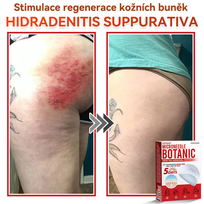 🎁 Zbývá už jen 5 balení! Nabízíme další slevu 50 %! Buďte fit a zdraví! Využijte této příležitosti právě teď, protože další už nebude až do příštího roku.