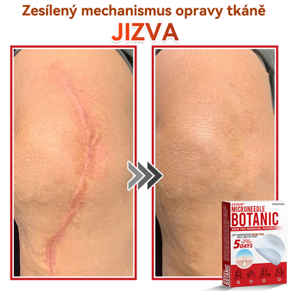 🎁 Zbývá už jen 5 balení! Nabízíme další slevu 50 %! Buďte fit a zdraví! Využijte této příležitosti právě teď, protože další už nebude až do příštího roku.