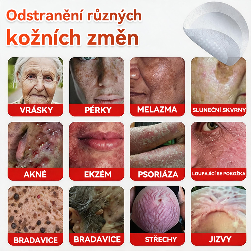 🔥🔥GFOUK® Mikrojehličková botanická náplast na odstranění bradavic
