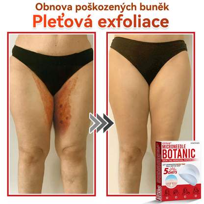 🎁 Zbývá už jen 5 balení! Nabízíme další slevu 50 %! Buďte fit a zdraví! Využijte této příležitosti právě teď, protože další už nebude až do příštího roku.