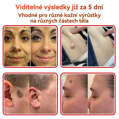 🎁 Zbývá už jen 5 balení! Nabízíme další slevu 50 %! Buďte fit a zdraví! Využijte této příležitosti právě teď, protože další už nebude až do příštího roku.