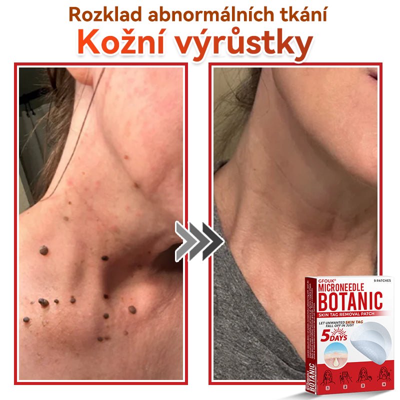 🎁 Zbývá už jen 5 balení! Nabízíme další slevu 50 %! Buďte fit a zdraví! Využijte této příležitosti právě teď, protože další už nebude až do příštího roku.