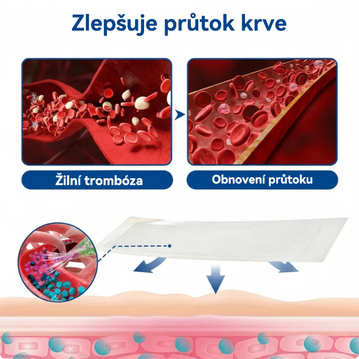 🏆🏆🇨🇿👨‍⚕️✅TAILEDEN® VeinEase Mikronáplast s mikrojehličkami⚡Okamžitá úleva, dlouhodobé výsledky