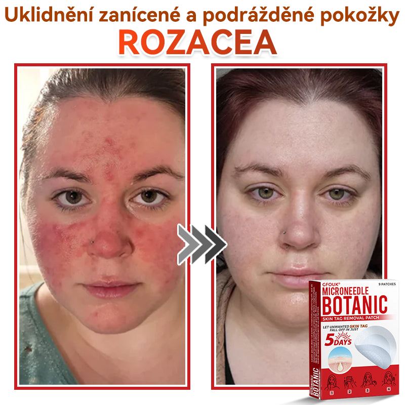 🎁 Zbývá už jen 5 balení! Nabízíme další slevu 50 %! Buďte fit a zdraví! Využijte této příležitosti právě teď, protože další už nebude až do příštího roku.