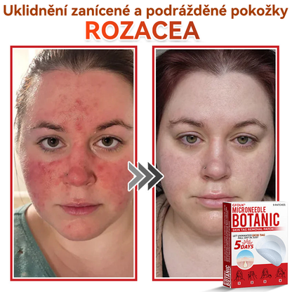 🎁 Zbývá už jen 5 balení! Nabízíme další slevu 50 %! Buďte fit a zdraví! Využijte této příležitosti právě teď, protože další už nebude až do příštího roku.
