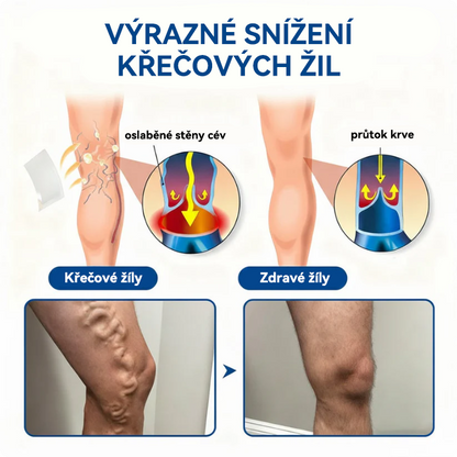 🏆🏆🇨🇿👨‍⚕️✅TAILEDEN® VeinEase Mikronáplast s mikrojehličkami⚡Okamžitá úleva, dlouhodobé výsledky