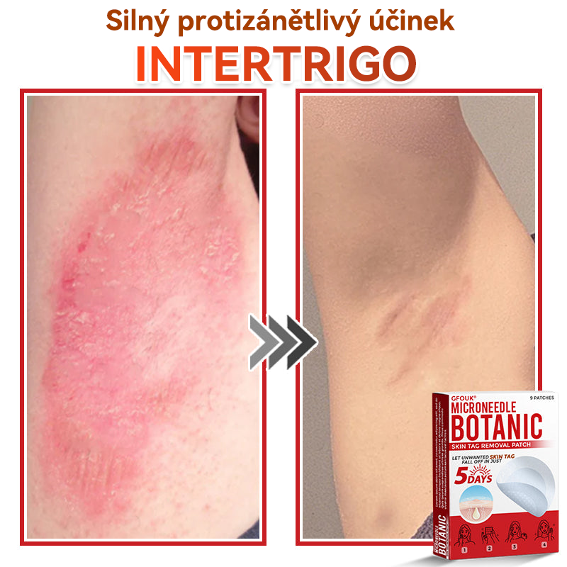 🎁 Zbývá už jen 5 balení! Nabízíme další slevu 50 %! Buďte fit a zdraví! Využijte této příležitosti právě teď, protože další už nebude až do příštího roku.