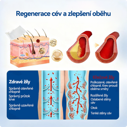 🏆🏆🇨🇿👨‍⚕️✅TAILEDEN® VeinEase Mikronáplast s mikrojehličkami⚡Okamžitá úleva, dlouhodobé výsledky